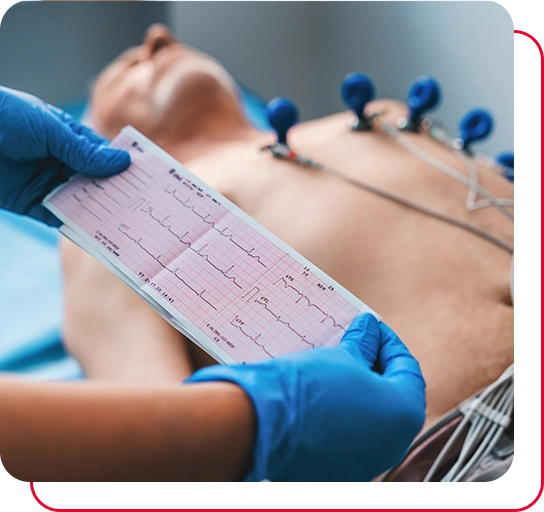 Electrocardiogram, ECG in hand